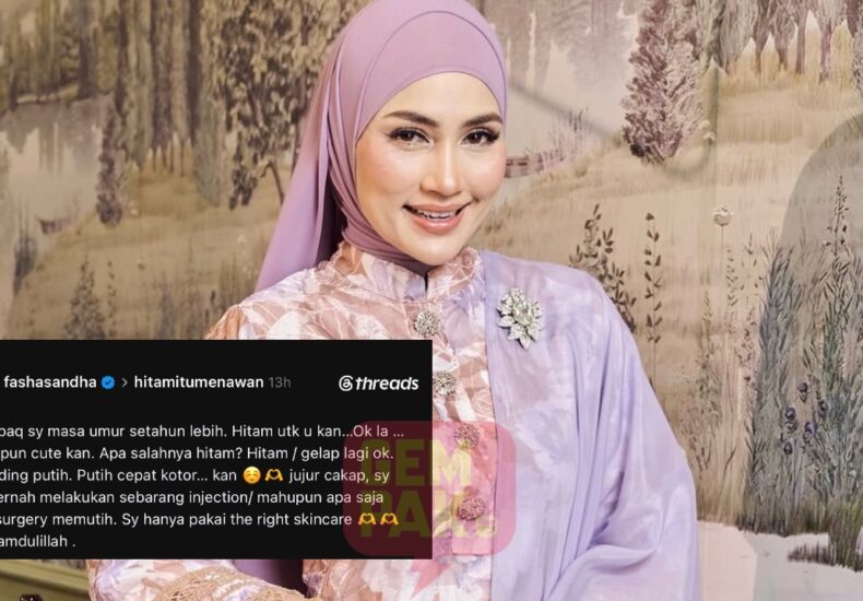 fasha sandha - ilustrasi berita Fasha Sandha: Hanya Guna Skincare Yang Tepat, Tegas Tolak Dakwaan Suntikan