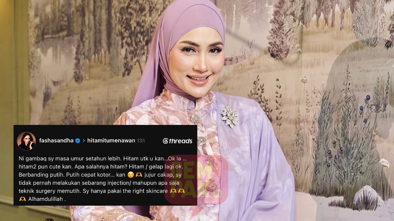 fasha sandha - ilustrasi berita Fasha Sandha: Hanya Guna Skincare Yang Tepat, Tegas Tolak Dakwaan Suntikan